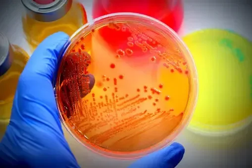 Illustration de l’article « Des analyses microbiologiques : Une obligation pour les professionnels de la restauration en remise directe ? »